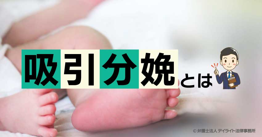 吸引分娩とは