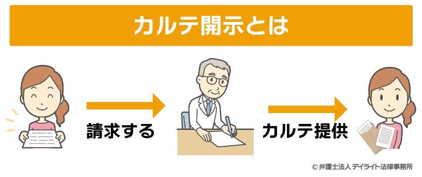 カルテ開示とは