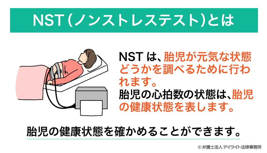 NST（ノンストレステスト）とは